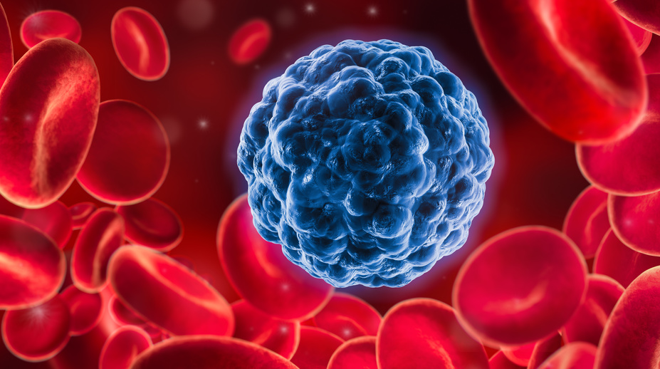 CAR-T-Zelltherapie_Krebszelle zwischen roten Blutkörperchen