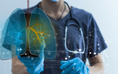 Lungenkrebs behandeln | Novartis - Arzt mit Bild einer Lunge