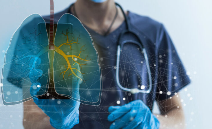 Lungenkrebs behandeln | Novartis - Arzt mit Bild einer Lunge