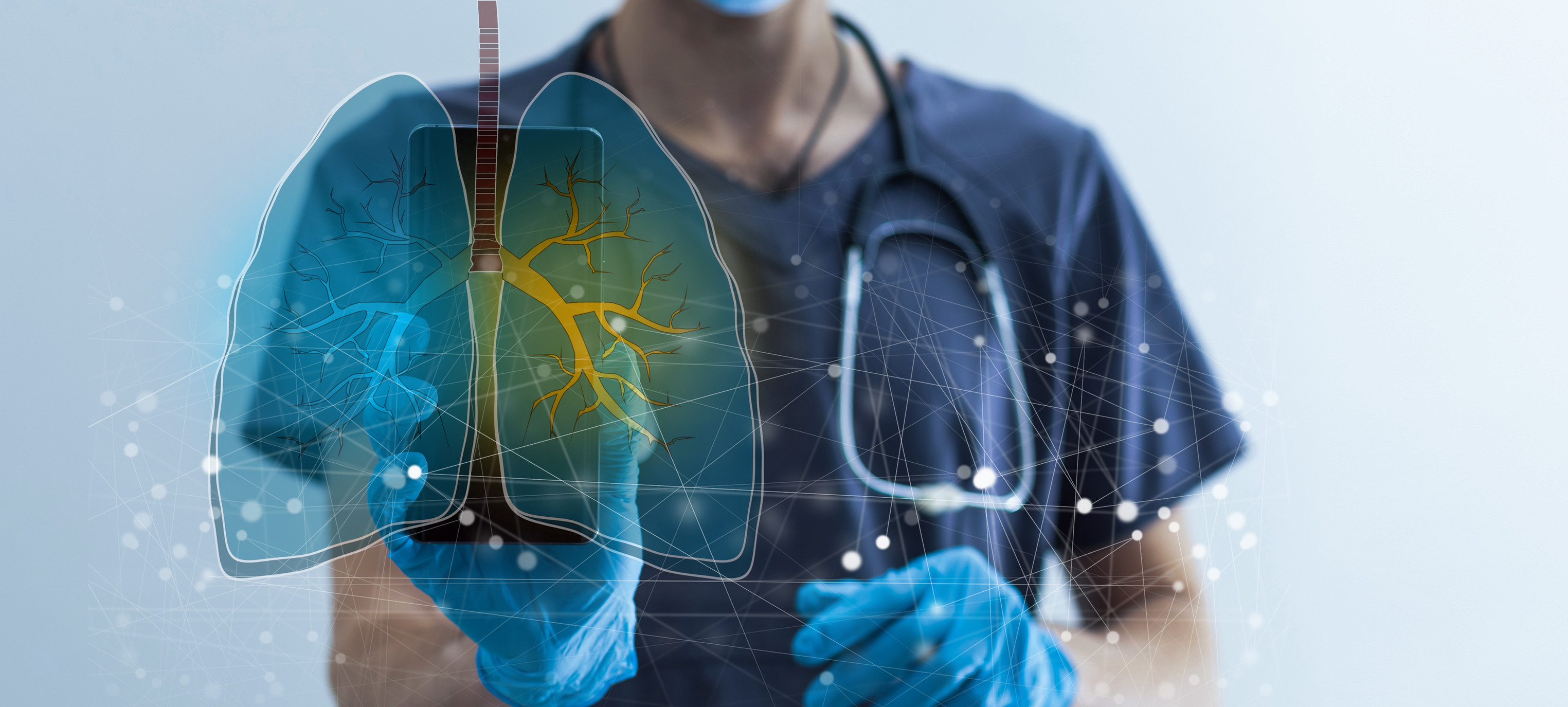 Lungenkrebs behandeln | Novartis - Arzt mit Bild einer Lunge