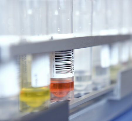 Biomarker Lungenkrebs | Novartis - klinische Forschung - Testtubes im Labor