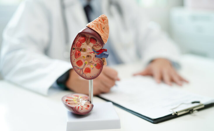 Seltene Nierenerkrankung | Novartis - klinische Forschung - Arzt mit Nierenmodell