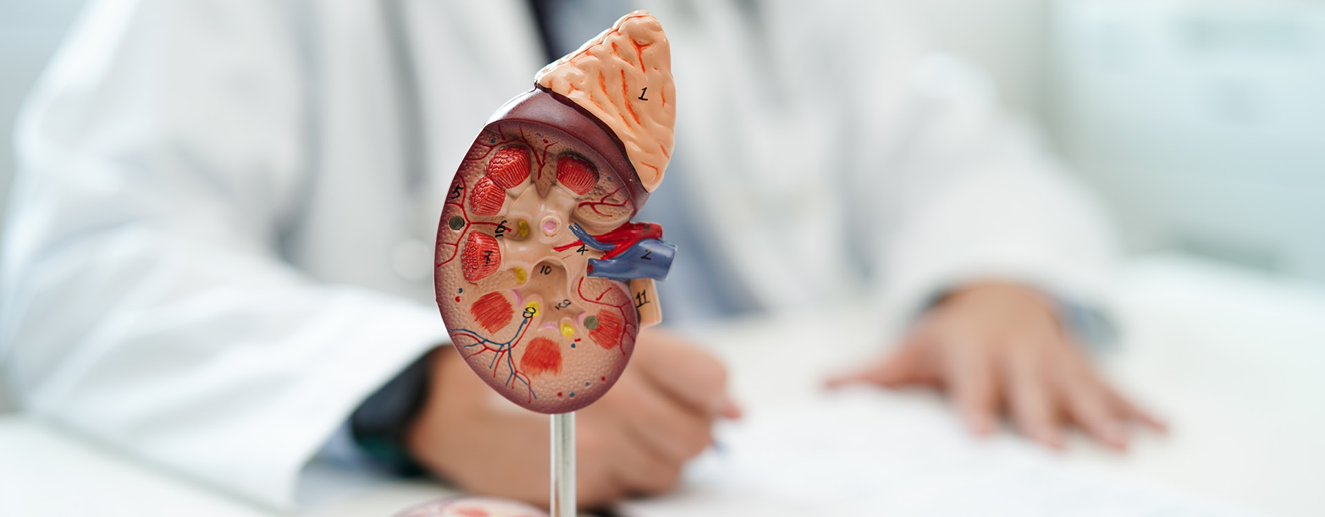 novartis-klinische-forschung-gut-informiert-gesundheitswissen-seltenen-nierenerkrankungen Anatomisches Modell einer Niere mit den Händen eines Arztes unscharf im Hintergrund.