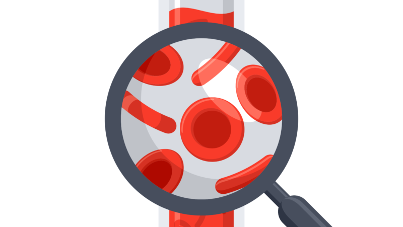 Illustration des Blutes in einem Blutgefäß das mit einer Lupe vergrößert wird.