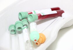 Blutproben-Röhrchen, die teilweise mit Blut gefüllt und teilweise leer sind.