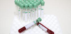 Zwei mit Blut gefüllte Blutprobenröhrchen liegen auf einem Halter mit mehreren leeren Blutprobenröhrchen vor hellem Hintergrund.