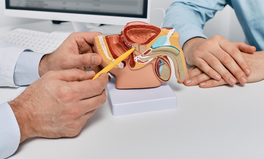 Ein Arzt zeigt deutet mit einem Kugelschreiber auf die Prostata bei einem anatomischen Modell.