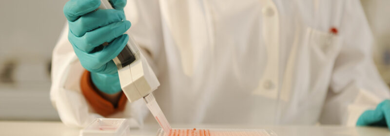 Novartis | klinische Forschung | EBV | Labortechniker führt Text mit Pipette aus